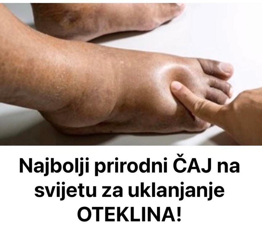 2Ć