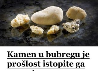 KAMEN U BUBREGU BIT ĆE PROŠLOST..ISTOPITE GA POMOĆU OVOG DOMAĆEG LIJEKA