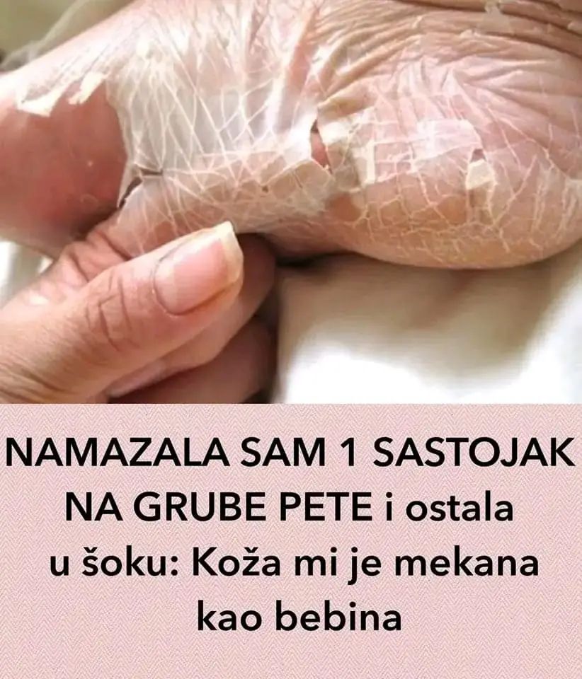 GHJKŽ