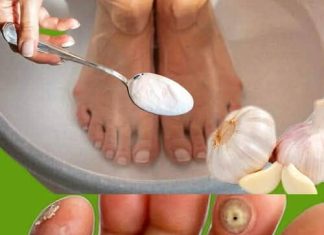 Imate li kurje oči ili znate nekoga tko ima? Evo kako ih se riješiti preko noći uz ovu moćnu mješavinu