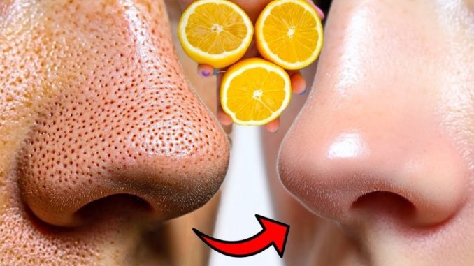 12 ČUDESNIH BEAUTY MOĆI LIMUNA 🍋 – Prirodni recepti za savršeno blistavu kožu - featured image 12 ČUDESNIH BEAUTY MOĆI LIMUNA 🍋 – Prirodni recepti za savršeno blistavu kožu - featured image