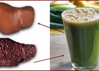 KADA JE JETRA PUNA TOKSINA I VI SE DEBLJATE: Sa ovim napitkom OČISTITE JETRU u potpunosti ZA 72 SATA! KADA JE JETRA PUNA TOKSINA I VI SE DEBLJATE: Sa ovim napitkom OČISTITE JETRU u potpunosti ZA 72 SATA! - featured image