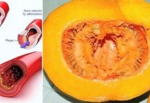 DOKTORI PREDLAŽU: Koristeći ovaj recept recite ZBOGOM povišenom holesterolu, šećeru u krvi, masnoćama i trigliceridima! DOKTORI PREDLAŽU: Koristeći ovaj recept recite ZBOGOM povišenom holesterolu, šećeru u krvi, masnoćama i trigliceridima! - featured image